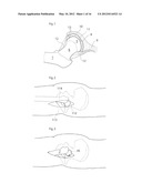 JOINT DEVICE AND METHOD diagram and image