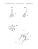 JOINT DEVICE AND METHOD diagram and image