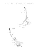 JOINT DEVICE AND METHOD diagram and image