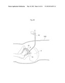 JOINT DEVICE AND METHOD diagram and image