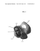 EARLY INTERVENTION KNEE IMPLANT DEVICE AND METHODS diagram and image