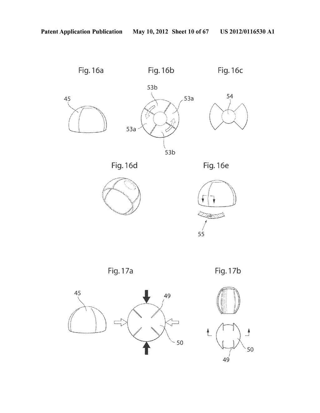 HIP JOINT DEVICE AND METHOD - diagram, schematic, and image 11