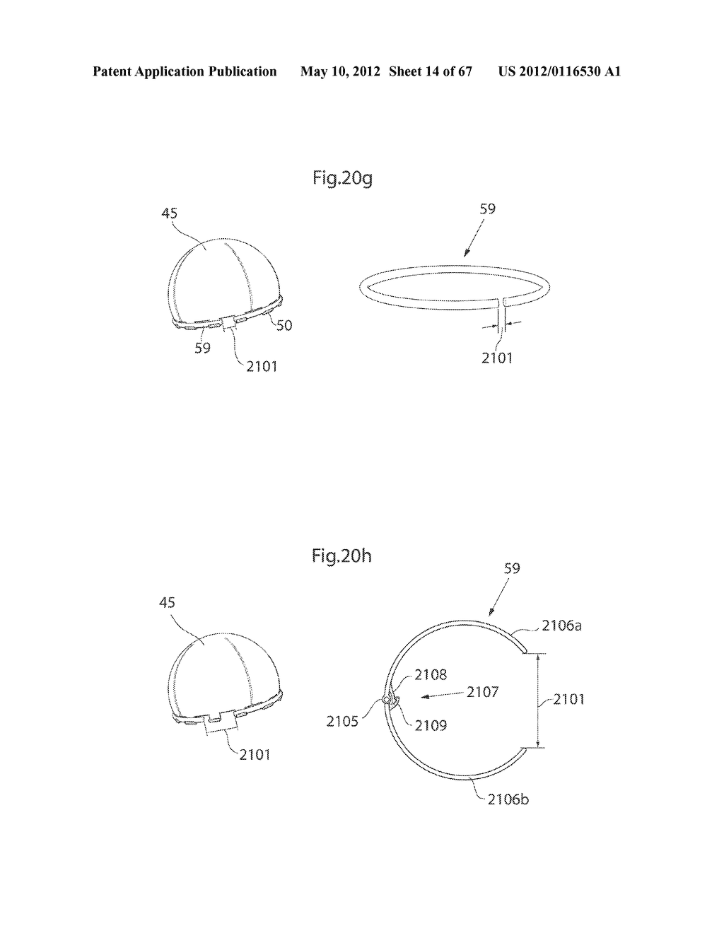 HIP JOINT DEVICE AND METHOD - diagram, schematic, and image 15