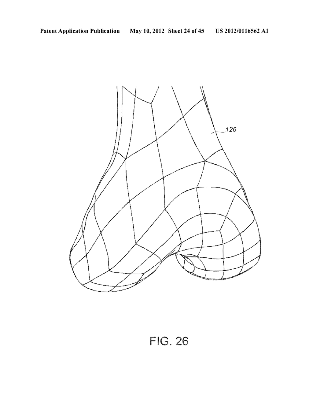 Systems and methods Utilizing Patient-Matched Instruments - diagram, schematic, and image 25