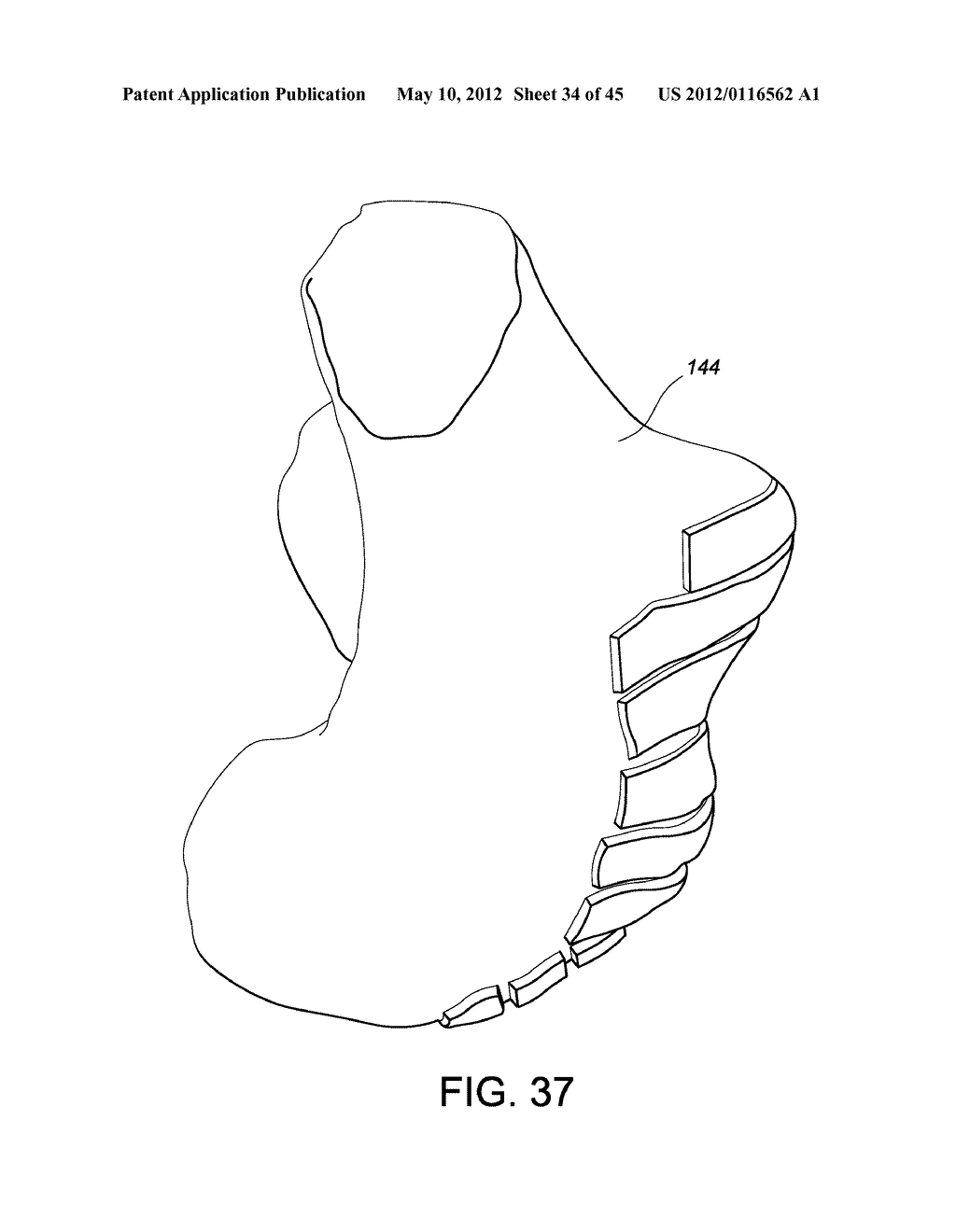 Systems and methods Utilizing Patient-Matched Instruments - diagram, schematic, and image 35