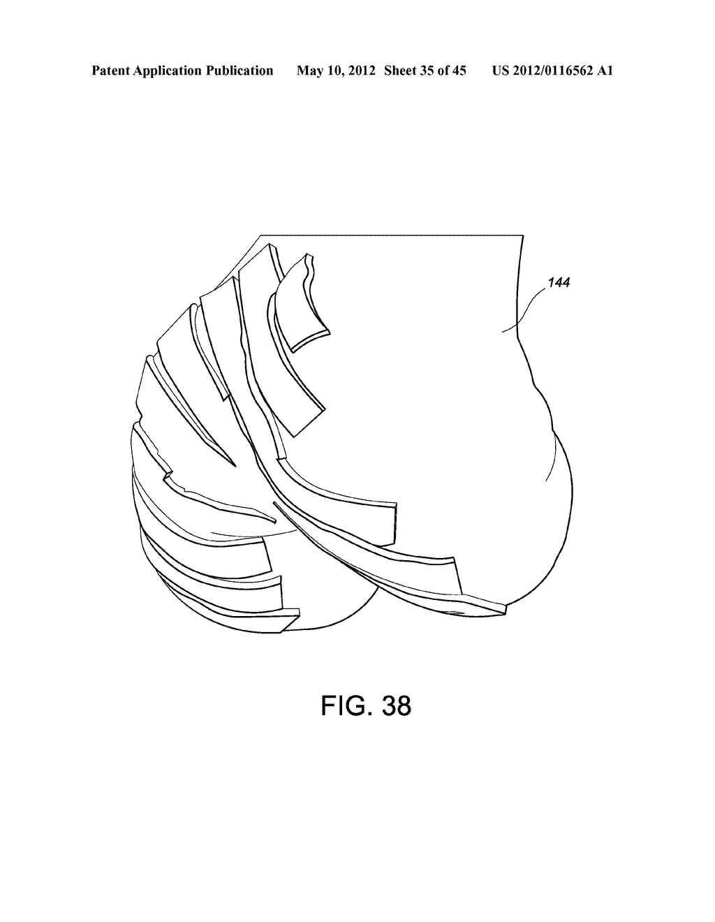 Systems and methods Utilizing Patient-Matched Instruments - diagram, schematic, and image 36