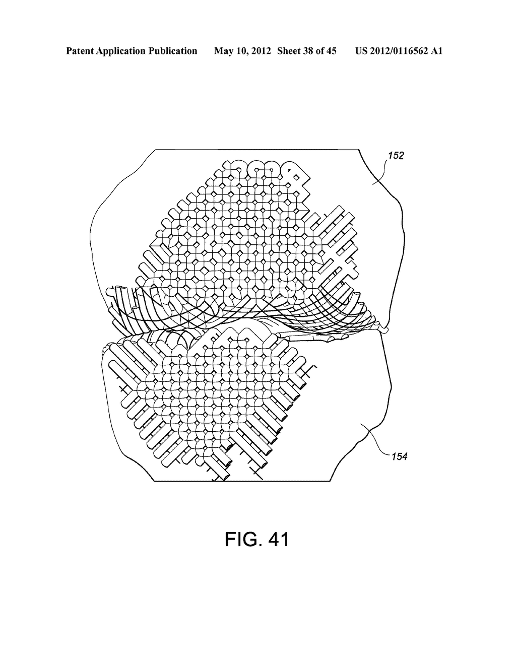 Systems and methods Utilizing Patient-Matched Instruments - diagram, schematic, and image 39