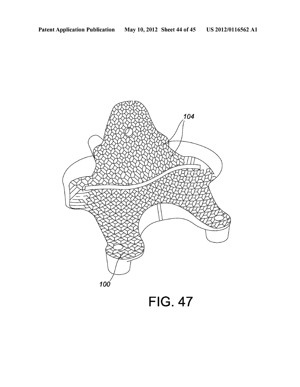 Systems and methods Utilizing Patient-Matched Instruments - diagram, schematic, and image 45