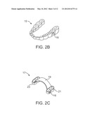 STUTTERING TREATMENT METHODS AND APPARATUS diagram and image