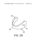 STUTTERING TREATMENT METHODS AND APPARATUS diagram and image