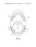 STUTTERING TREATMENT METHODS AND APPARATUS diagram and image