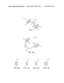 STUTTERING TREATMENT METHODS AND APPARATUS diagram and image