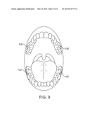 STUTTERING TREATMENT METHODS AND APPARATUS diagram and image