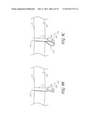 COMPOUND GARMENT diagram and image