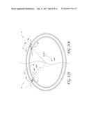 COMPOUND GARMENT diagram and image