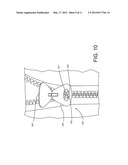 ZIPPER ARRANGEMENT WITH WHEELED SLIDER diagram and image