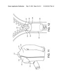 ZIPPER ARRANGEMENT WITH WHEELED SLIDER diagram and image