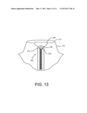 ZIPPER ARRANGEMENT WITH WHEELED SLIDER diagram and image