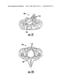 VALVE MOUNTING ADAPTOR diagram and image