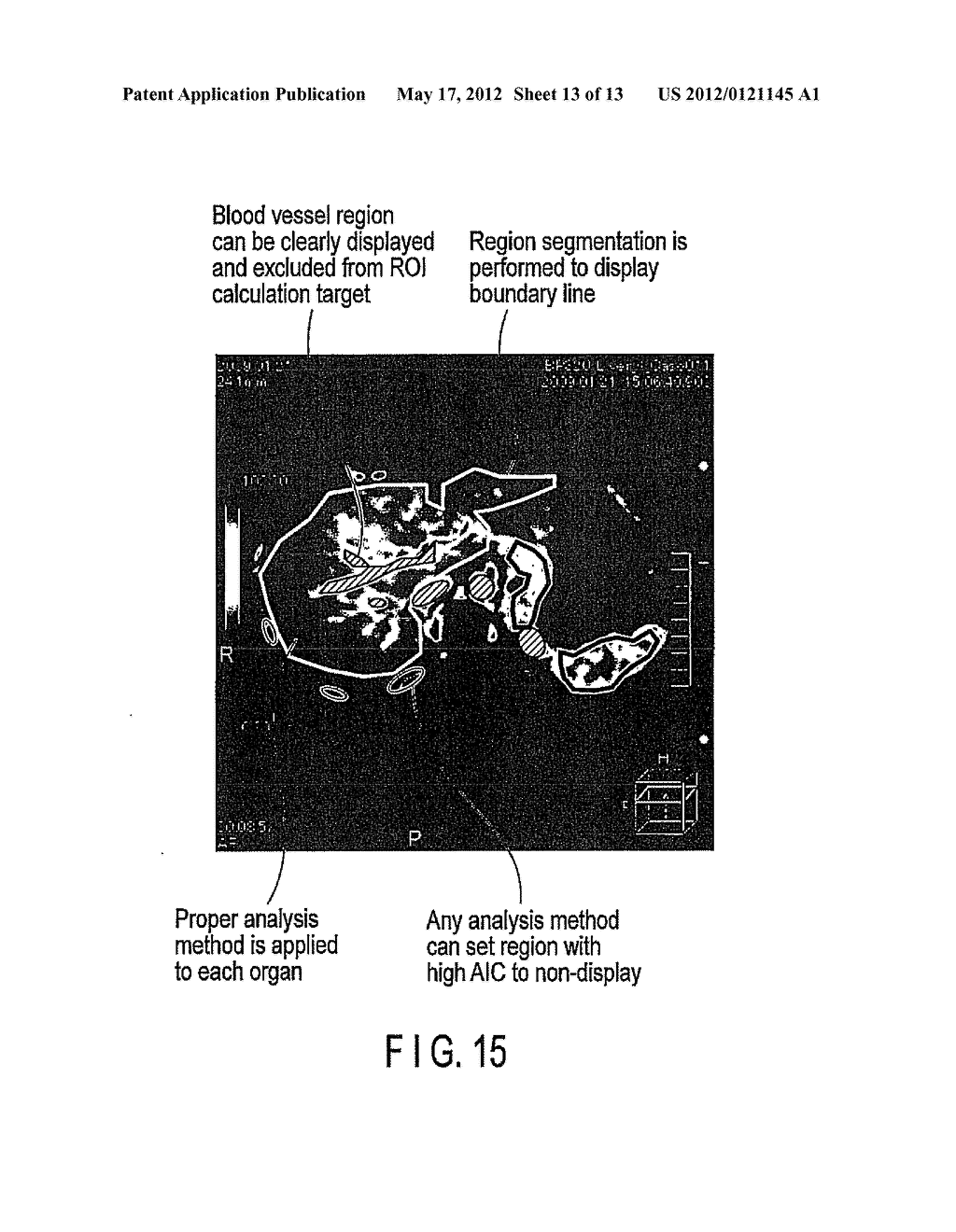 MEDICAL IMAGE PROCESSING APPARATUS - diagram, schematic, and image 14