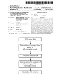 Device And Computed Tomography Scanner For Determining And Visualizing The     Perfusion Of The Myocardial Muscle diagram and image