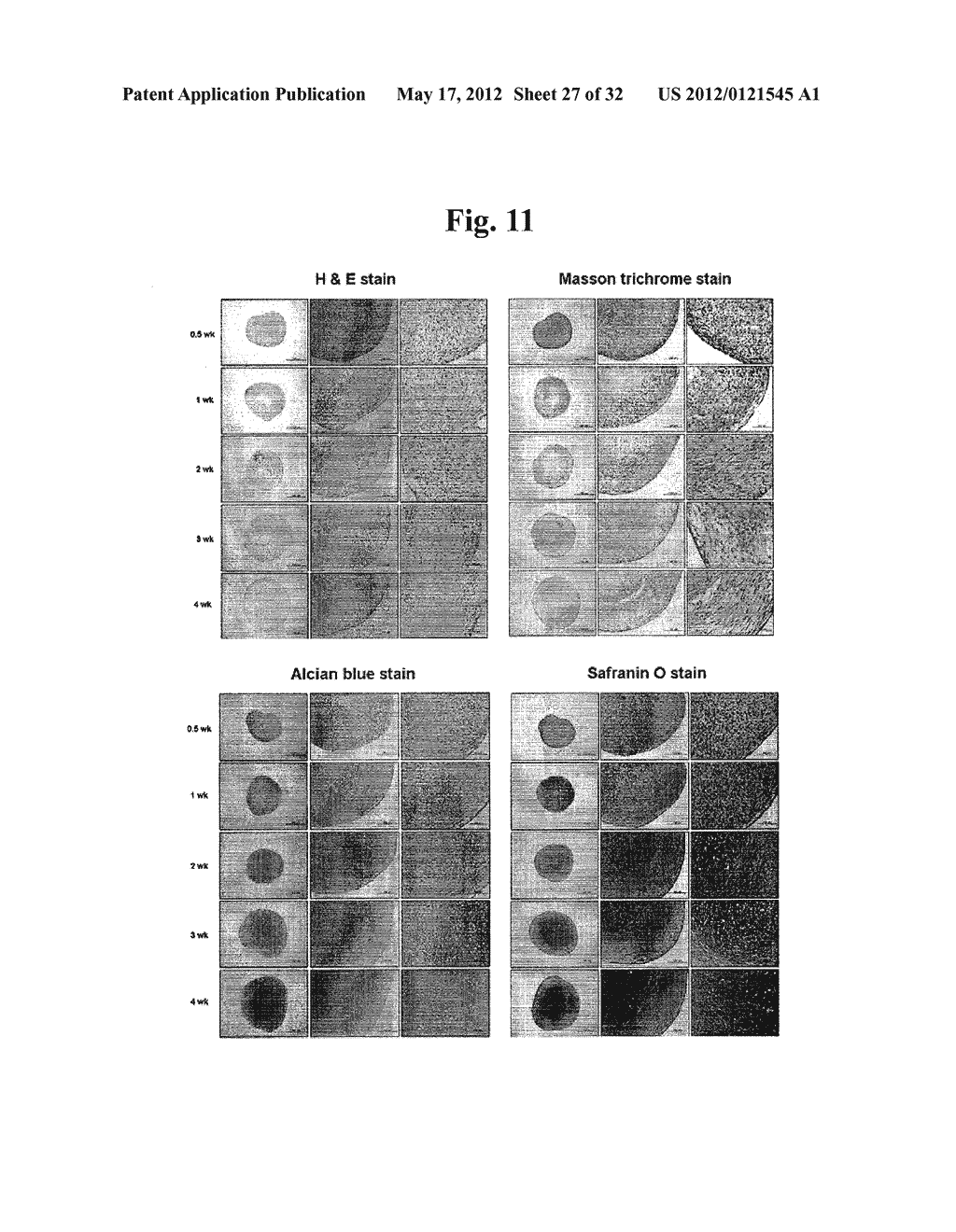 Pharmaceutical Composition For Bone Disease Treatment Or Countering     Inflammation, Comprising Cartilage Stem Cells As An Active Principle - diagram, schematic, and image 28