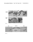 METHODS FOR GENERATING NEW HAIR FOLLICLES, TREATING BALDNESS, AND HAIR     REMOVAL diagram and image