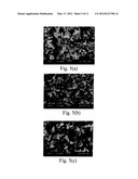 Acetazolamide Microparticle And Its Preparation Method And Use diagram and image