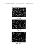 Acetazolamide Microparticle And Its Preparation Method And Use diagram and image