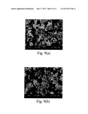 Acetazolamide Microparticle And Its Preparation Method And Use diagram and image