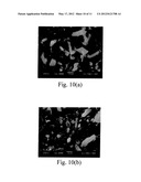 Acetazolamide Microparticle And Its Preparation Method And Use diagram and image