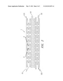 DOUBLE LAYERED UNIAXIALLY ELONGATED FOAM POLYMER MEMBRANE STRUCTURE diagram and image