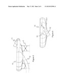 SLIDING BOWL WITH WATER JET SYSTEM diagram and image