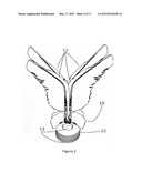 GAME, FITNESS, STRENGTHENING AND REHABILITATION, COORDINATION IMPROVEMENT     DEVICE, SHUTTLECOCK, AND CUSTOMIZABLE COLLECTIBLE diagram and image