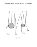 GAME, FITNESS, STRENGTHENING AND REHABILITATION, COORDINATION IMPROVEMENT     DEVICE, SHUTTLECOCK, AND CUSTOMIZABLE COLLECTIBLE diagram and image