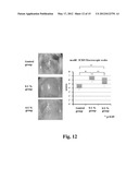 SUBSTRATE FOR CARTILAGE CULTIVATION USING ARTIFICIAL COLLAGEN, AND METHOD     FOR CARTILAGE REGENERATION TREATMENT USING THE SUBSTRATE diagram and image