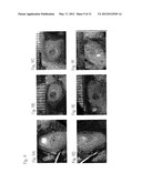 ULTRA-HIGH STRENGTH INJECTABLE HYDROGEL AND PROCESS FOR PRODUCING THE SAME diagram and image