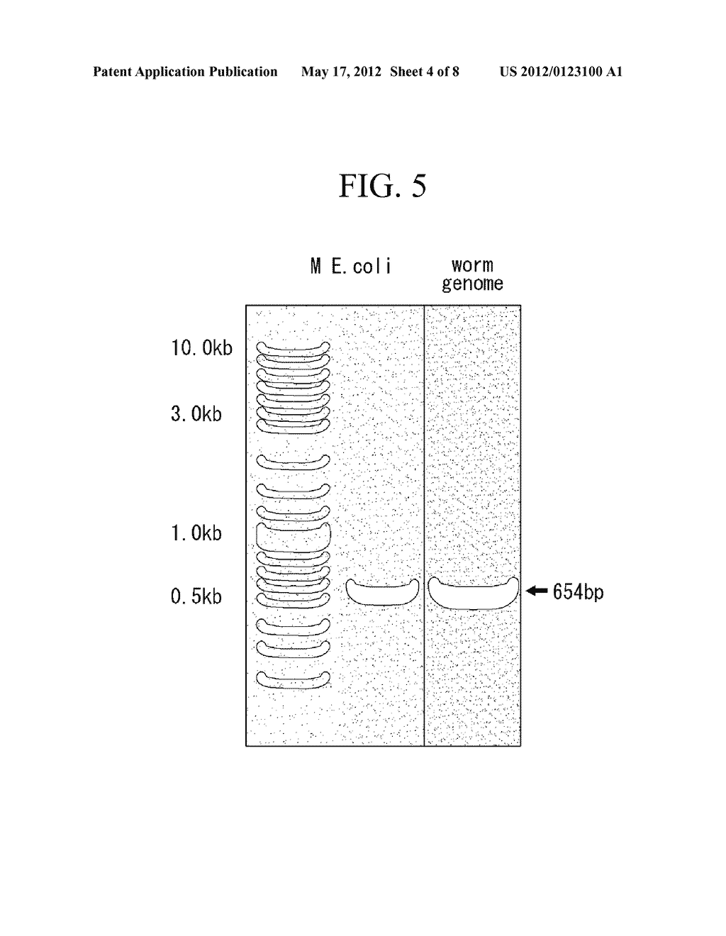 METHOD FOR PRODUCING TRANSFORMED EARTHWORMS USING EARTHWORM     GONAD-REGENERATION CAPABILITY, TRANSFORMED EARTHWORMS THEREOF, AND METHOD     FOR PRODUCING RECOMBINANT PROTEINS FROM TRANSFORMED EARTHWORM BODY FLUIDS - diagram, schematic, and image 05