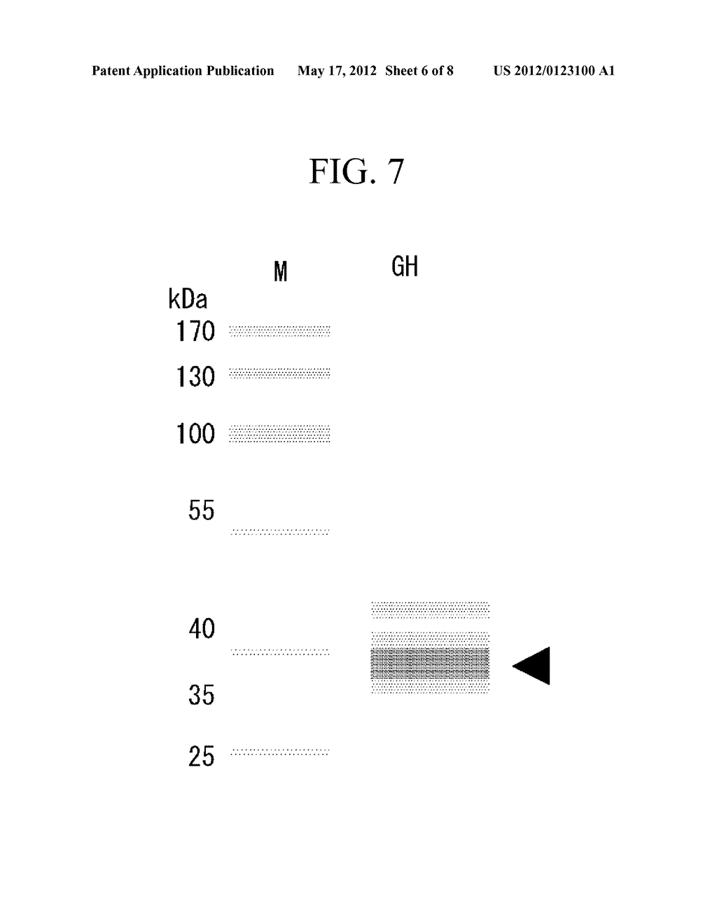 METHOD FOR PRODUCING TRANSFORMED EARTHWORMS USING EARTHWORM     GONAD-REGENERATION CAPABILITY, TRANSFORMED EARTHWORMS THEREOF, AND METHOD     FOR PRODUCING RECOMBINANT PROTEINS FROM TRANSFORMED EARTHWORM BODY FLUIDS - diagram, schematic, and image 07