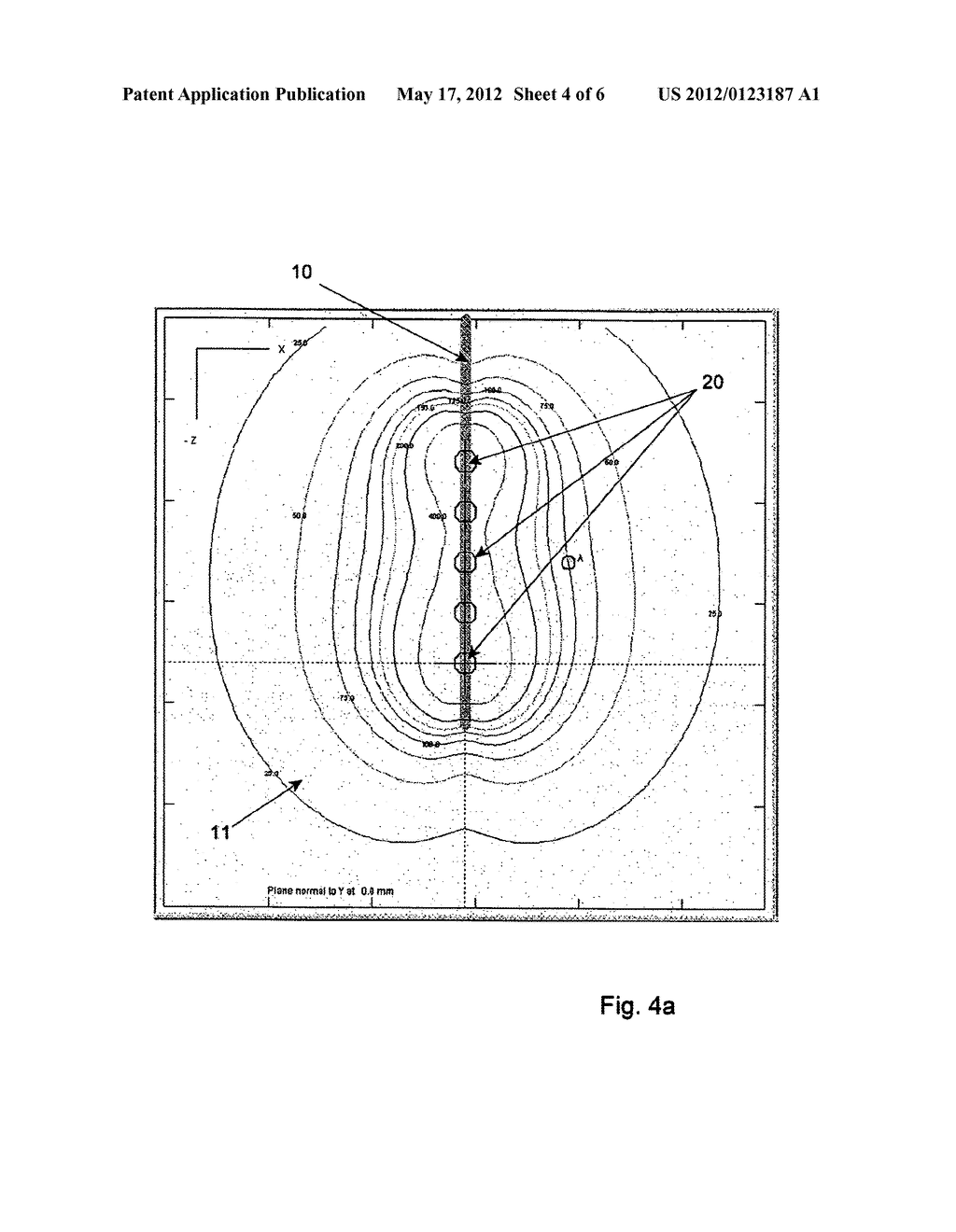 System and Method for Generating a Radiation Treatment Plan for Use in     Effecting Radiation Therapy in a Human or Animal Body - diagram, schematic, and image 05