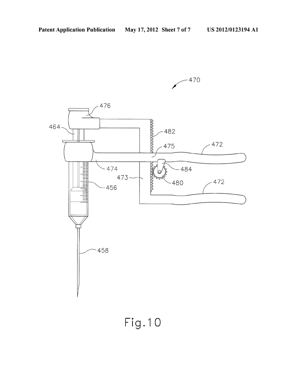 PRESSURE LIMITING DEVICE FOR GASTRIC BAND ADJUSTMENT - diagram, schematic, and image 08