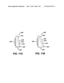 GASTRIC BAND WITH ASYMMETRICAL MEMBER diagram and image