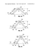 GASTRIC BAND DEVICES AND DRIVE SYSTEMS diagram and image