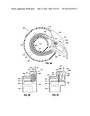 GASTRIC BAND DEVICES AND DRIVE SYSTEMS diagram and image