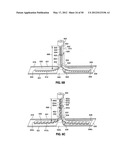 GASTRIC BAND DEVICES AND DRIVE SYSTEMS diagram and image