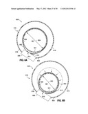 GASTRIC BAND DEVICES AND DRIVE SYSTEMS diagram and image