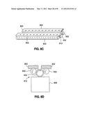 GASTRIC BAND DEVICES AND DRIVE SYSTEMS diagram and image