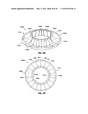 GASTRIC BAND DEVICES AND DRIVE SYSTEMS diagram and image