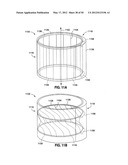 GASTRIC BAND DEVICES AND DRIVE SYSTEMS diagram and image