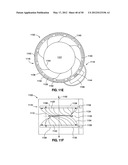 GASTRIC BAND DEVICES AND DRIVE SYSTEMS diagram and image